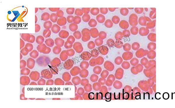人(ren)血塗片