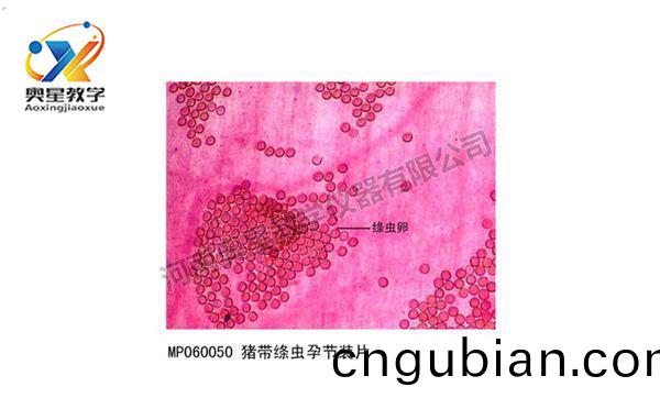 豬帶縧(tao)蟲孕(yun)節(jie)