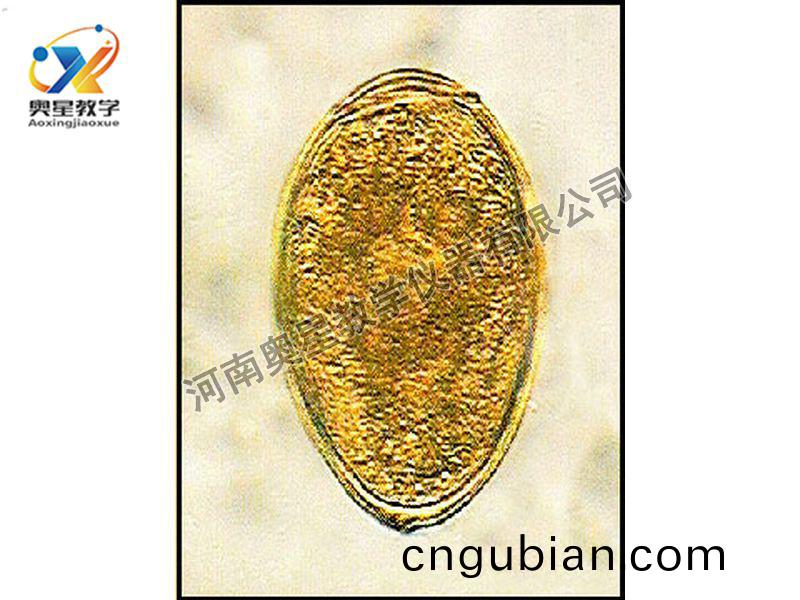 斯(si)氏(shi)竝殖(zhi)吸(xi)蟲(chong)卵(luan)原(yuan)圖(tu)
