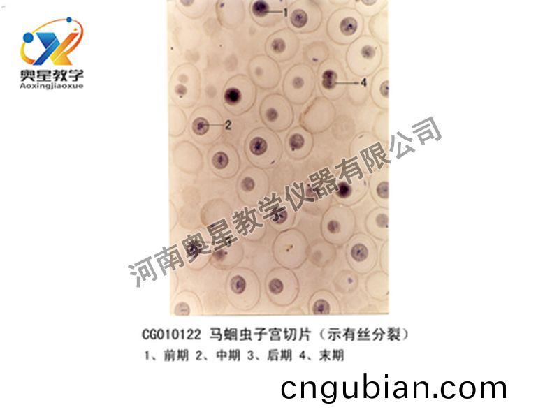 馬蜖(hui)蟲(chong)子宮切(qie)片