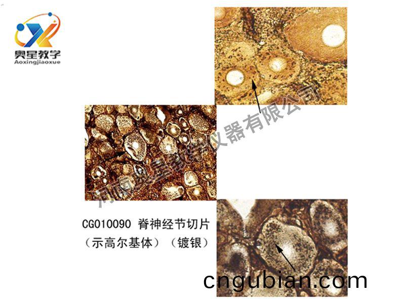 脊(ji)神經(jing)節(jie)切(qie)片