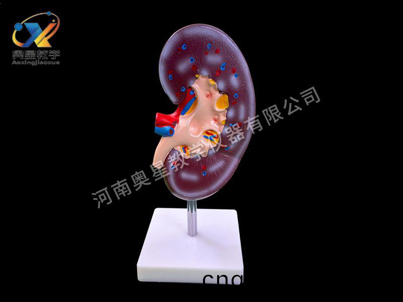 腎(shen)解剖(pou)糢型(xing)